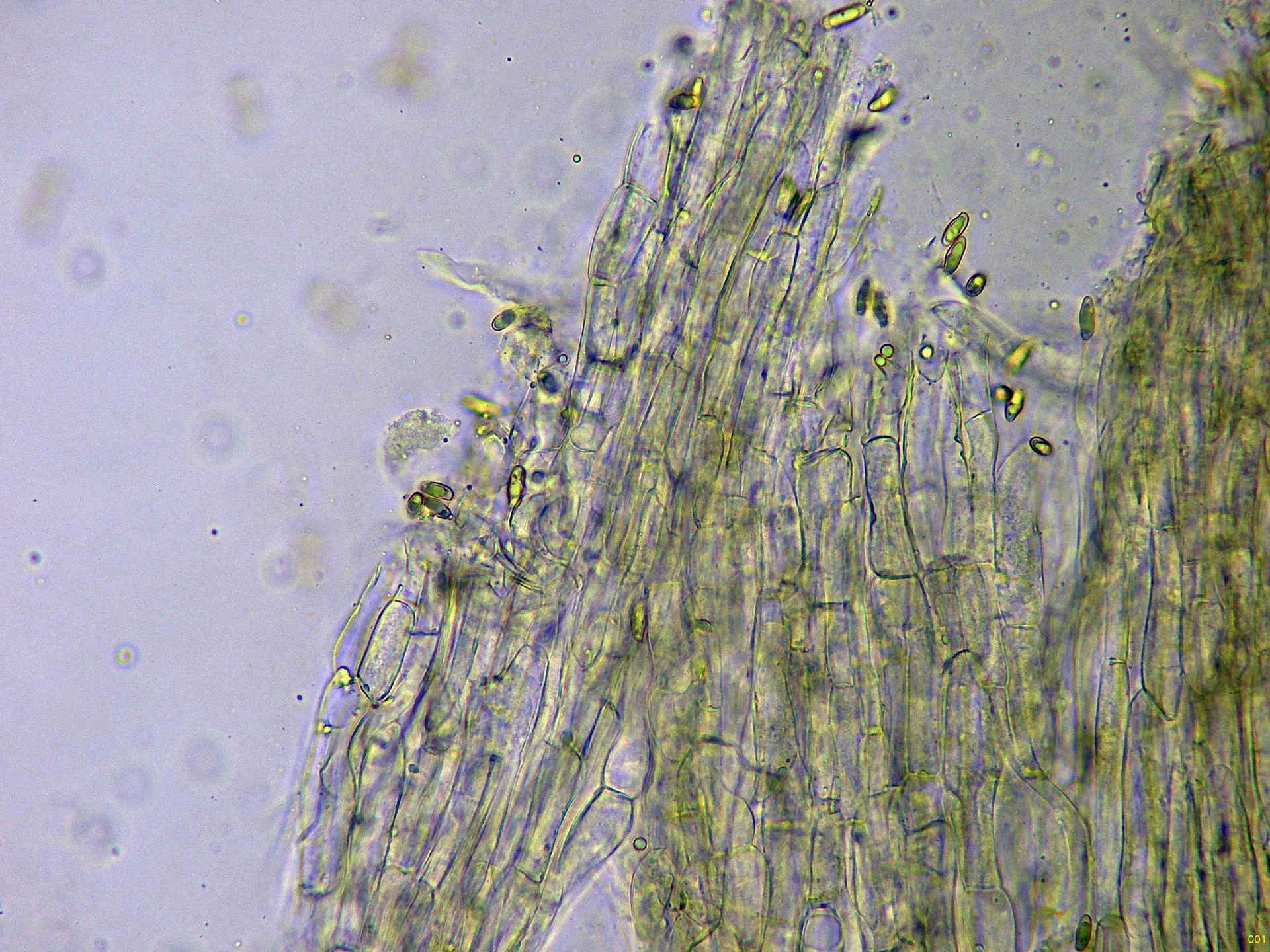 Microscopía de Phylloporus pelletieri - 10 - Caulopellis agua x 400-001